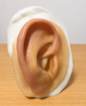 Prótesis Auricular Prótesis Auricular